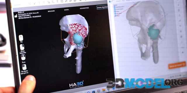 Revolutionizing Medicine: Exploring the Depths of 3D Modeling Technologies for Anatomical Precision