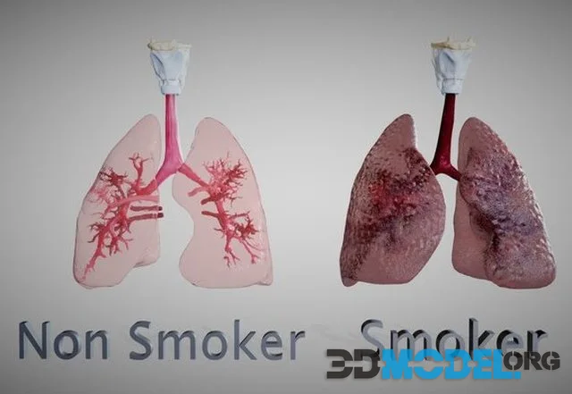 Smoker's Lungs VS Non Smoker's Lungs