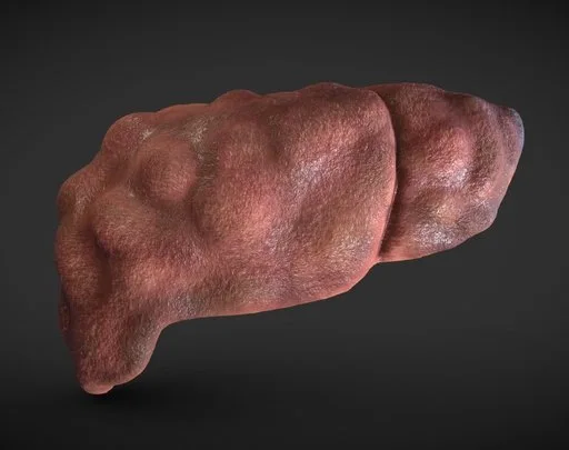 Hepatitis C