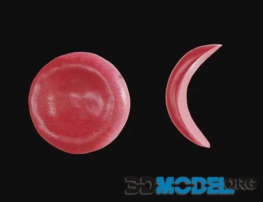 Normal Vs Sickle Red Blood Cell (PBR)
